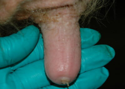 Orifice Hyperkeratosis, Eversions, Erosions and Open