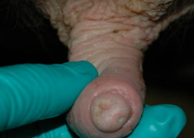 Orifice Hyperkeratosis, Eversions, Erosions and Open