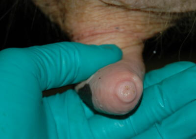 Orifice Hyperkeratosis, Eversions, Erosions and Open