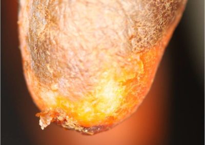 Dip Build-Up on Teats