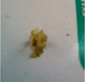 Dip Build-Up on Teats