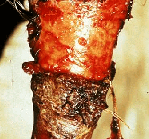 Photosensitivity and Allergies