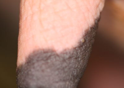 Typical Range of Teats (Normal Teats)