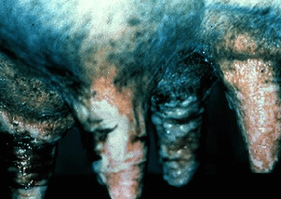 Vesticular Stomatitis